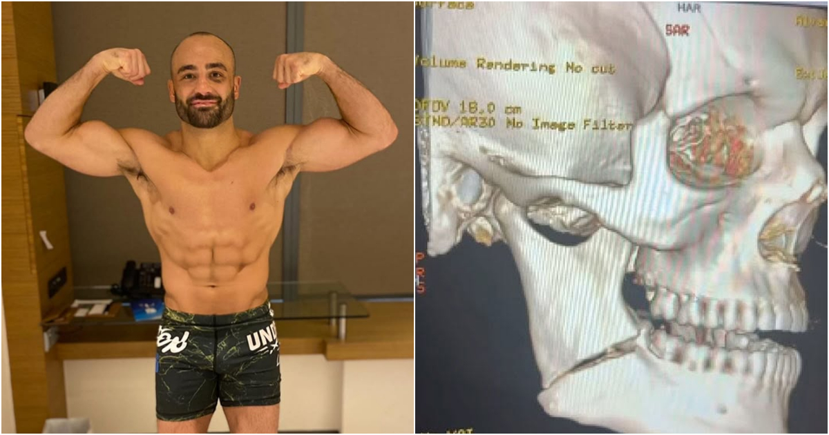 Eddie Alvarez złamał szczękę w walce na gołe pięści z Jeremym Stephensem